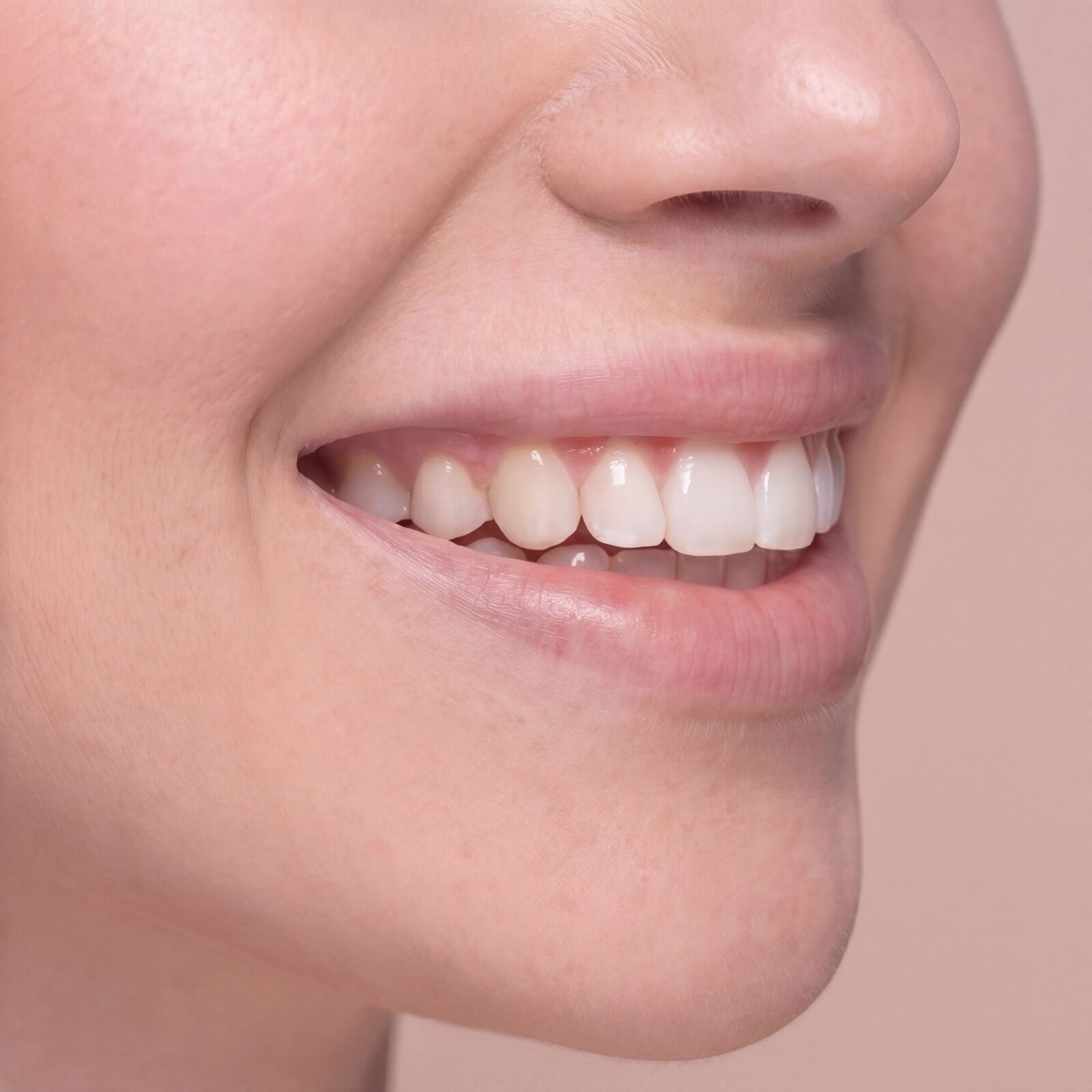 Zahnaufhellung Berybeauty Aesthetics GmbH      