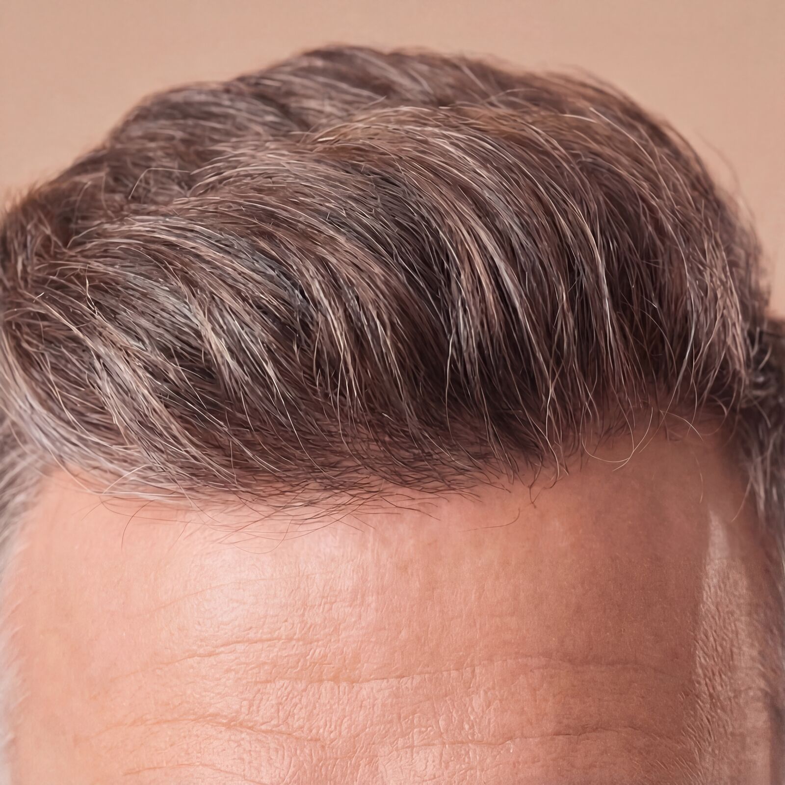 Haare Berybeauty Aesthetics GmbH      