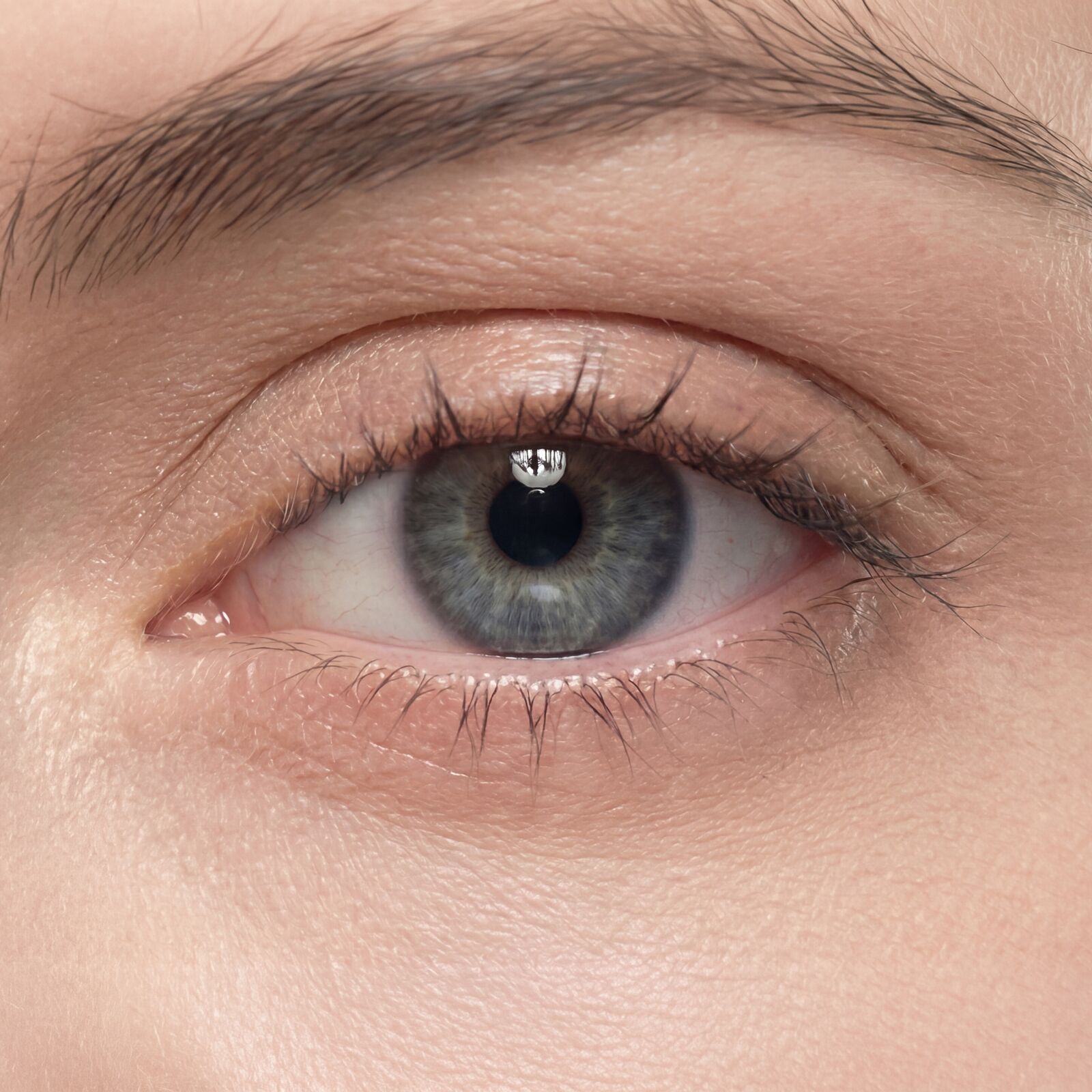 Augenringe Berybeauty Aesthetics GmbH      
