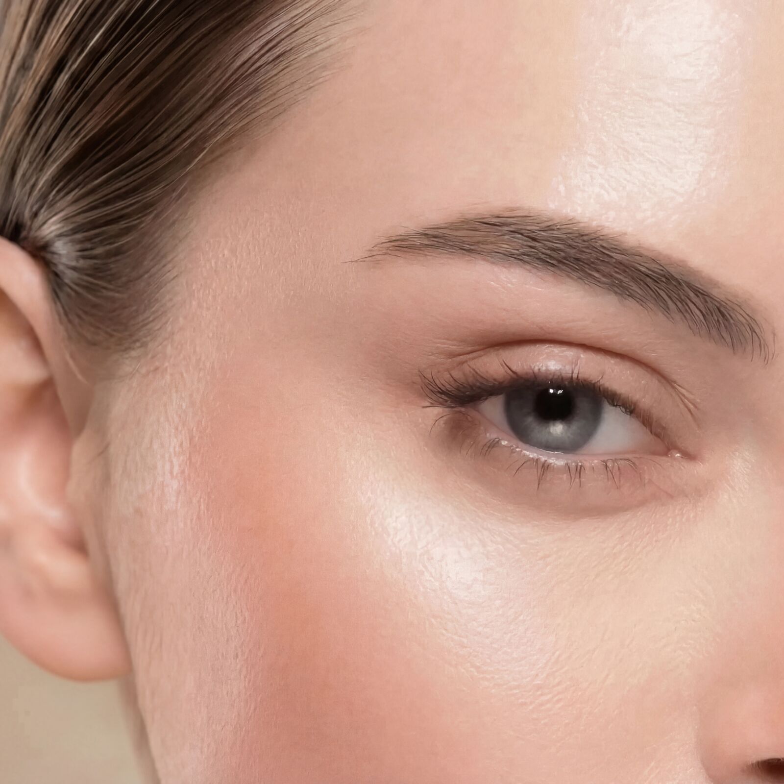 Schläfenaufbau Berybeauty Aesthetics GmbH      