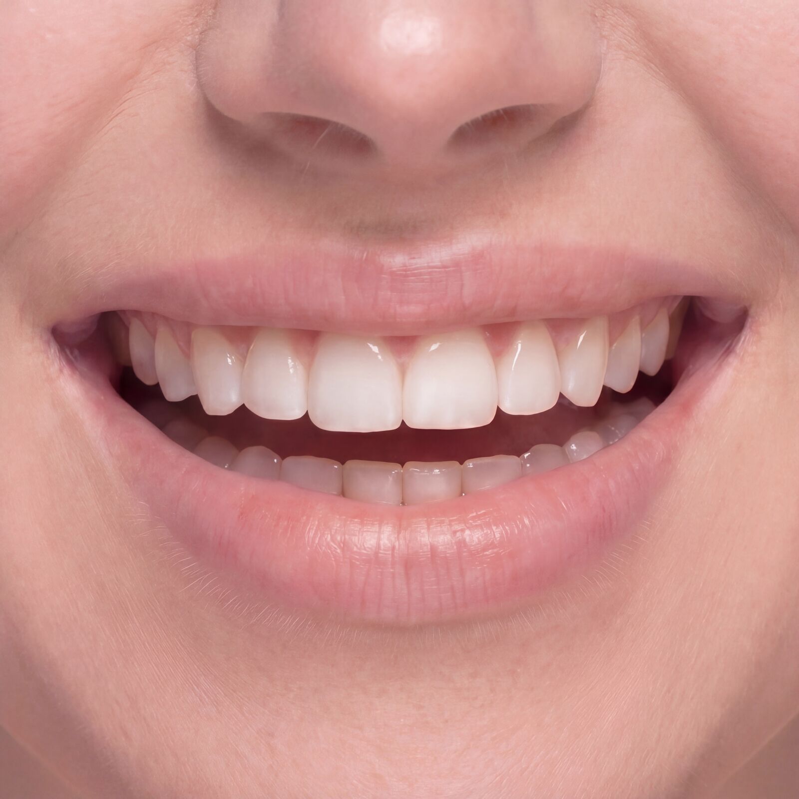 Zahnaufhellung Berybeauty Aesthetics GmbH      