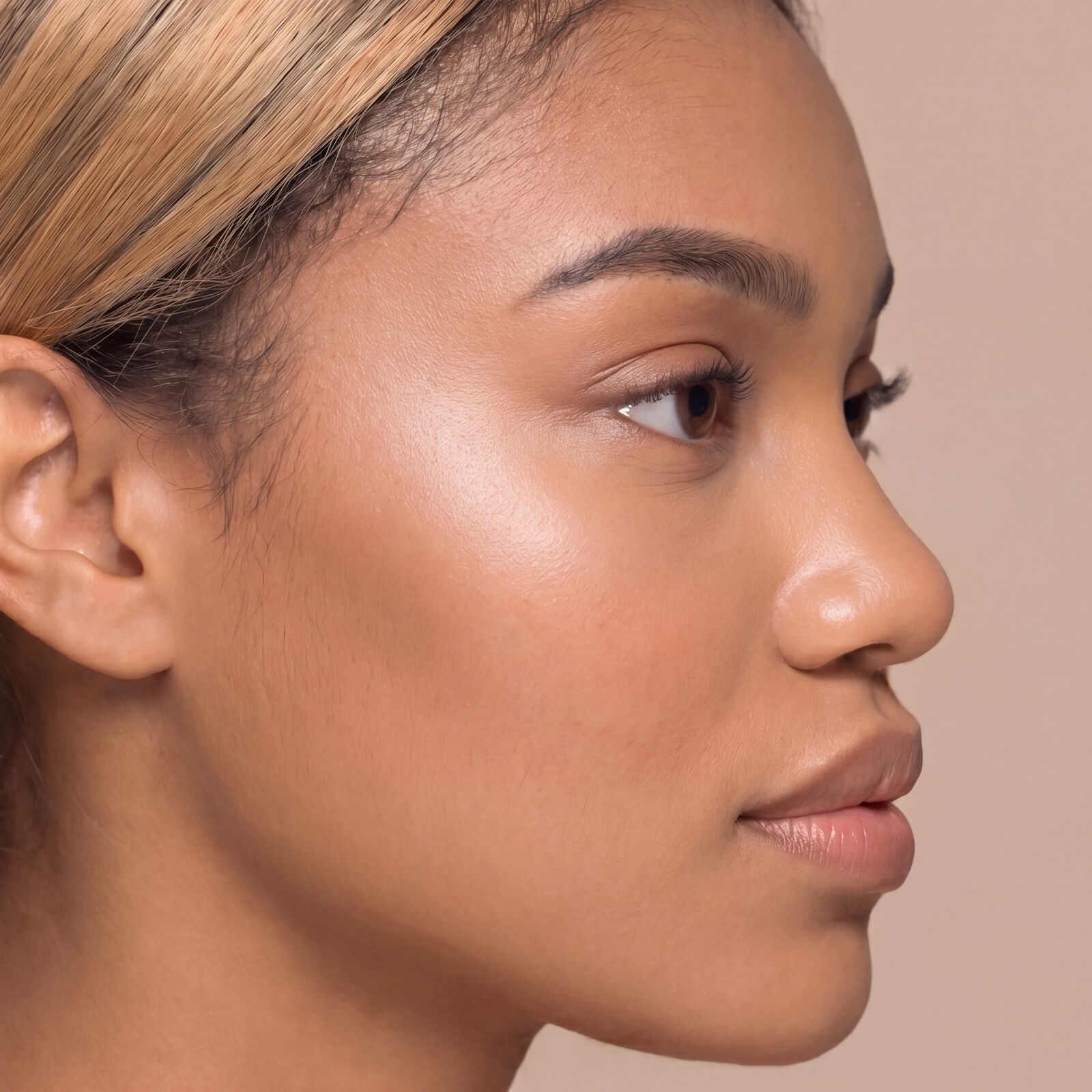 Radiesse Berybeauty Aesthetics GmbH      